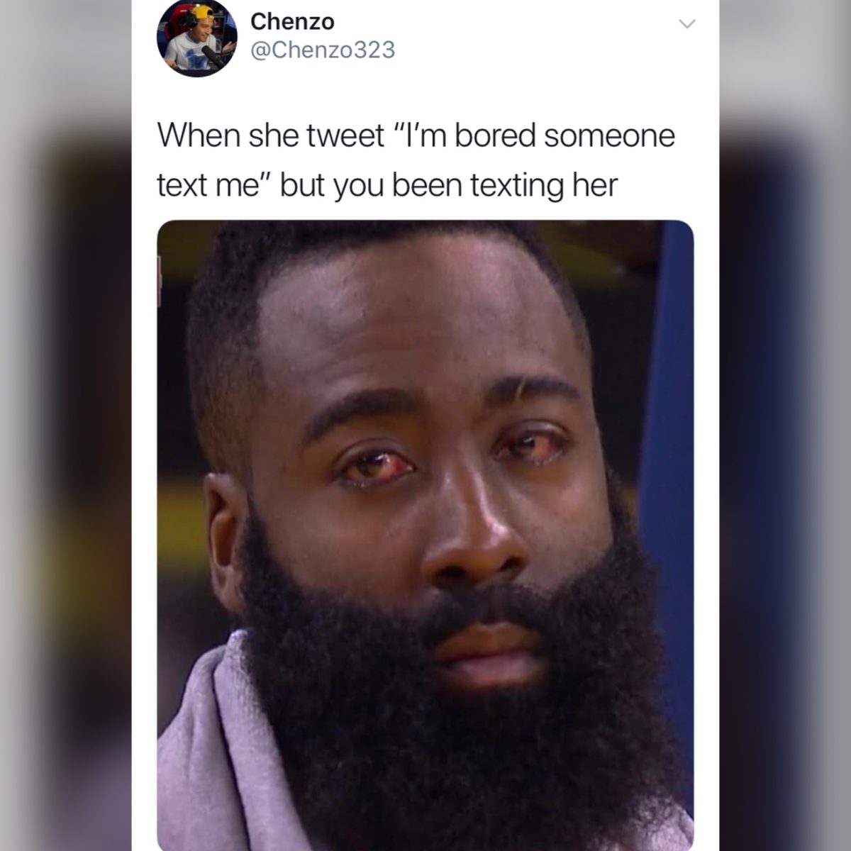 James Harden's Injured Eye Sparks New Meme