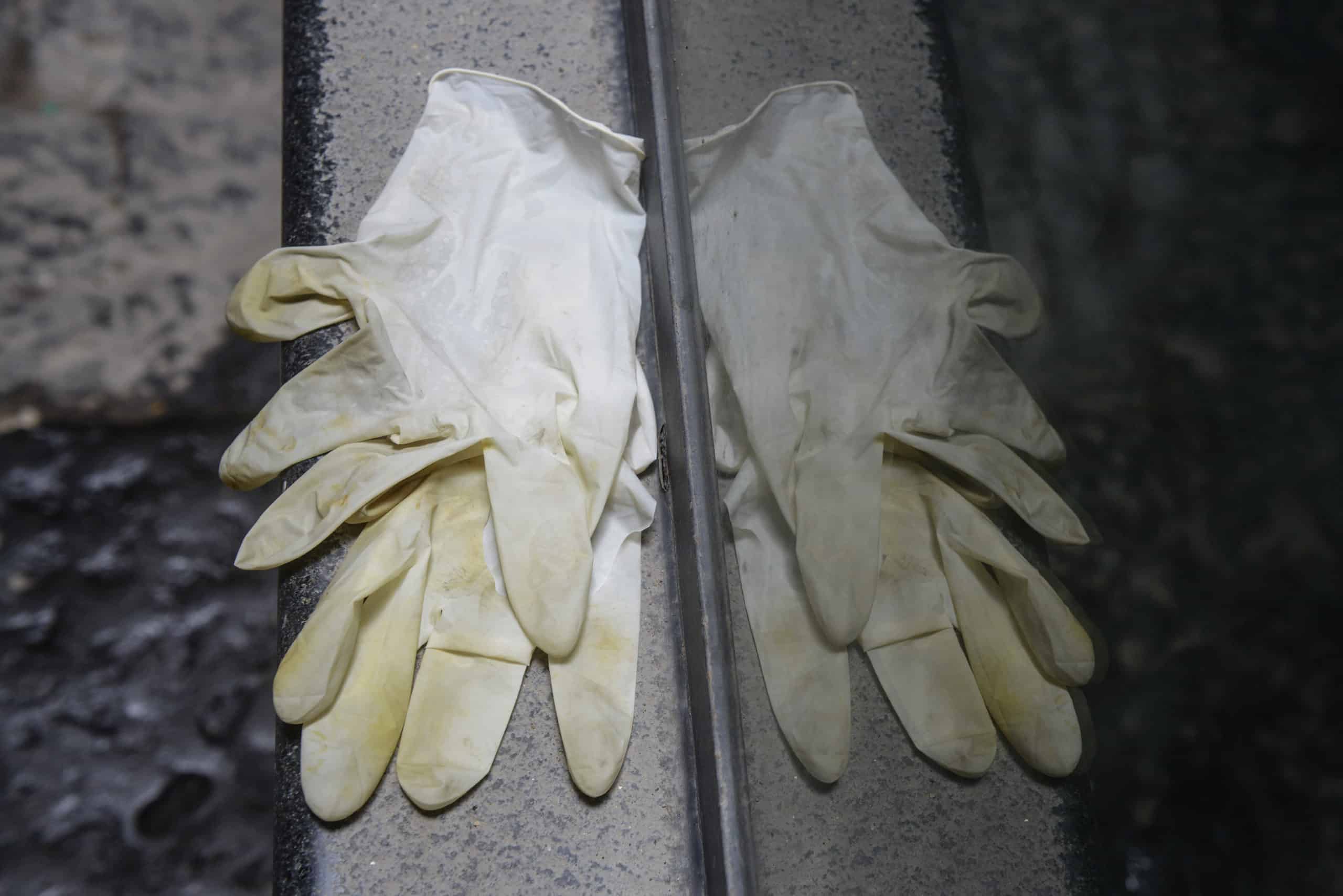 dirty-medical-gloves-imported
