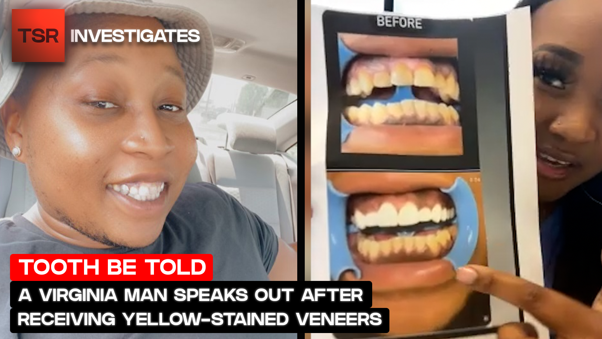 Virginia Rapper Receives Yellow-Stained Veneers, But Was He Really Scammed? #TSRInvestigates