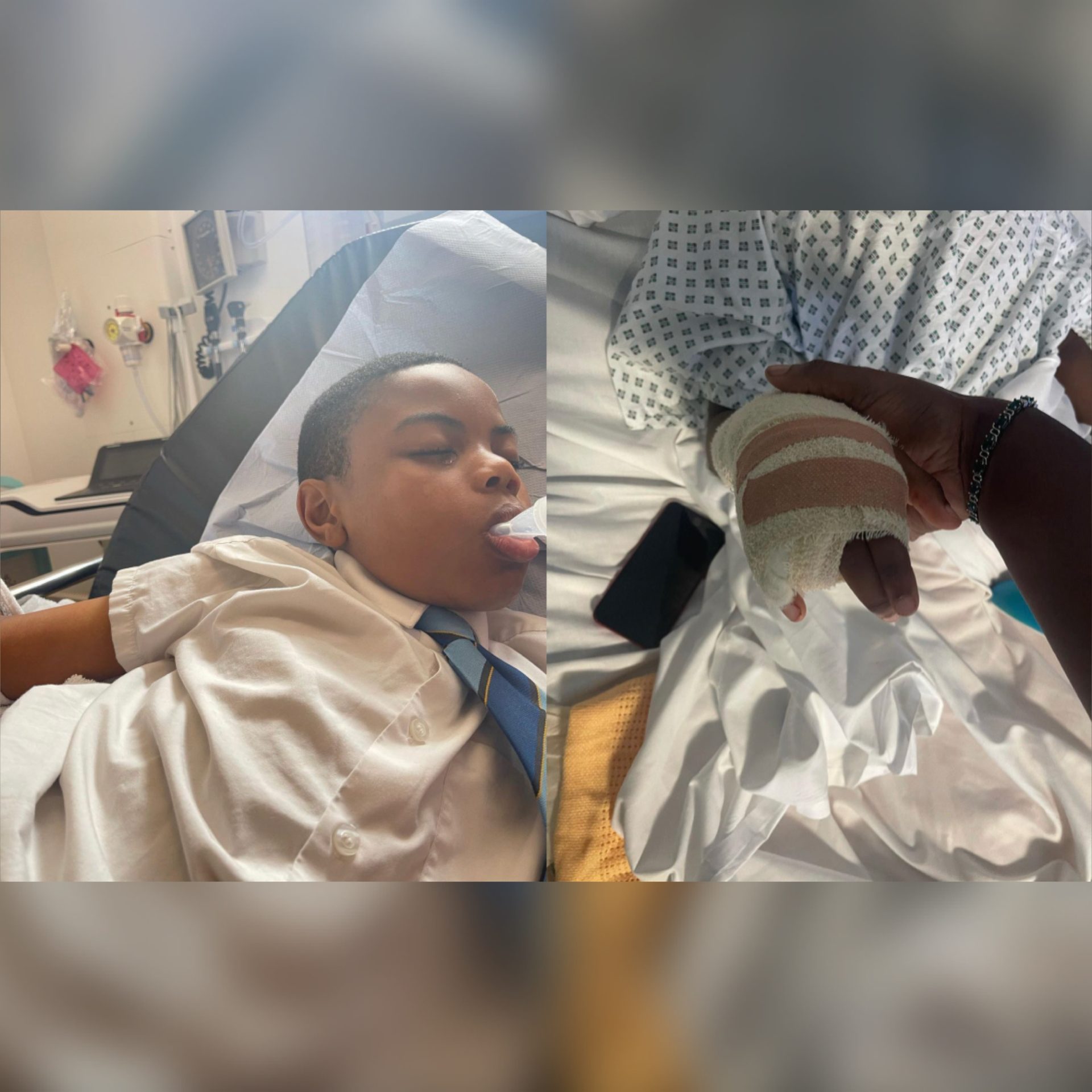 Young Boy Forced To Amputate Finger After Fleeing From Racist School Bullies