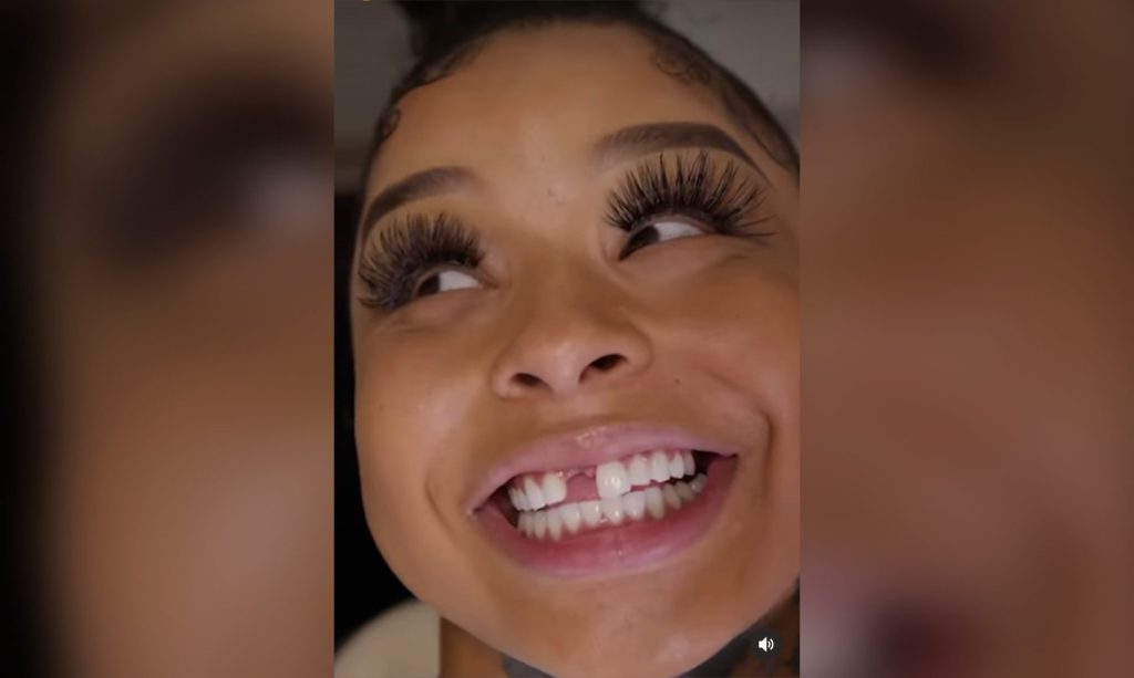 (Video) Say Cheese! Chrisean Rock Replaces Her Missing Tooth Then Says She Wants 