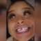 (Video) Say Cheese! Chrisean Rock Replaces Her Missing Tooth Then Says She Wants “A Gap”