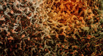 Experimental Chewing Gum Could Be Used To Help Reduce COVID-19 Transmissions