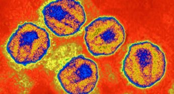 California Man Said To Be Cured Of HIV & Leukemia After Stem Cell Treatment