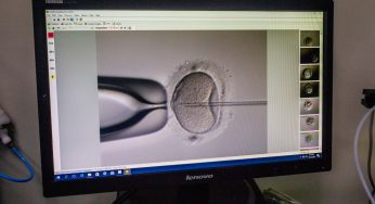 Healthy 23-Year-Old Woman Dies While Undergoing Routine Fertility Treatment After Suffering Effects Of Rare Complication