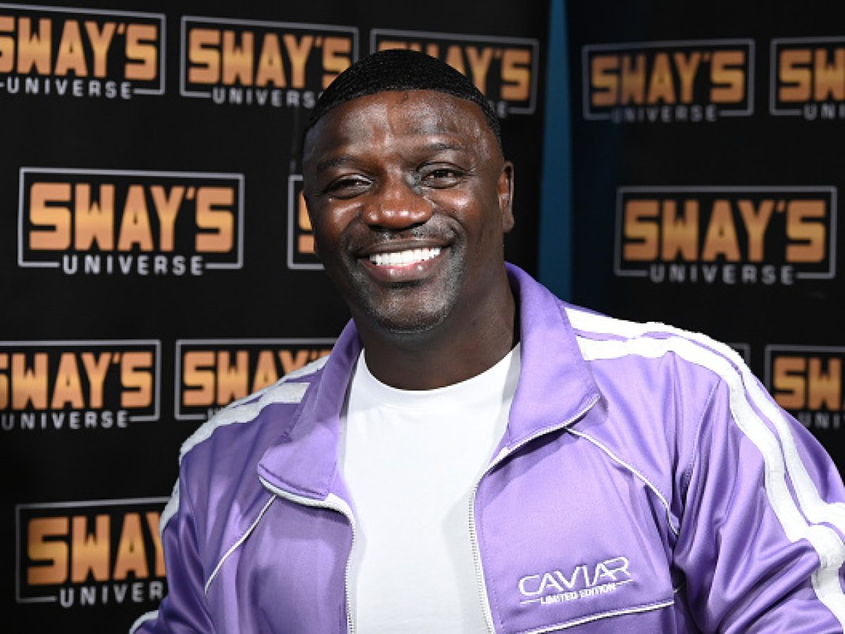Akon Got A $ Hair Transplant In Turkey To Achieve His New Hairline!