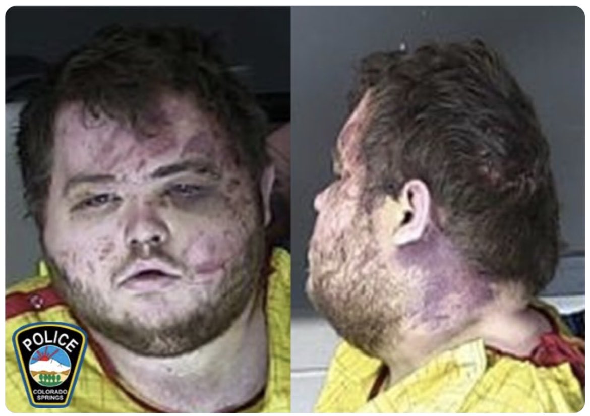 UPDATE: Accused Colorado Gay Club Mass Shooting Suspect Anderson Lee Aldrich Hit With 305 Charges