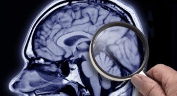 Study Suggests Obesity Can Spark Alzheimer’s-Like Patterns In Brain