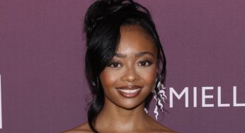 Skai Jackson Seeks Advice As She Opens Up About Her Postpartum Hair Loss Journey (VIDEO)