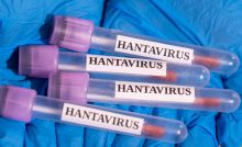 Evacuations For Cruise Ship Begin After Hantavirus Outbreak Leaves Multiple Dead (VIDEO)