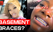 Basement Braces Are Going Viral And Dentists Are Concerned | TSR Investigates