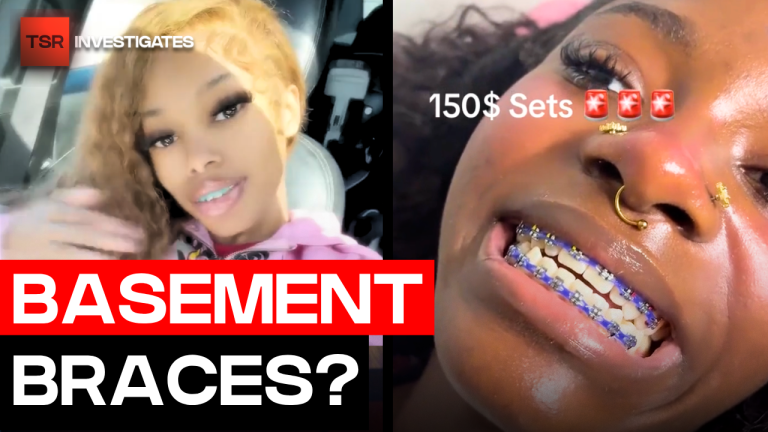 “Basement Braces” Are Going Viral And Dentists Are Concerned | TSR Investigates Basement Braces Are Going Viral And Dentists Are Concerned | TSR Investigates